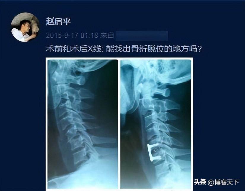 为什么要给影视剧主角开微博。